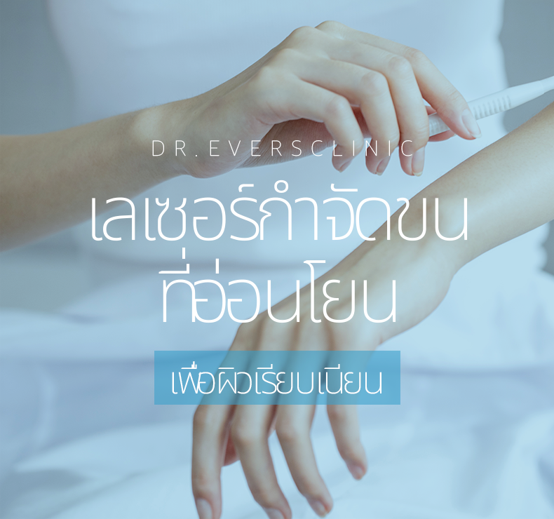 กำจัดขนผู้หญิง