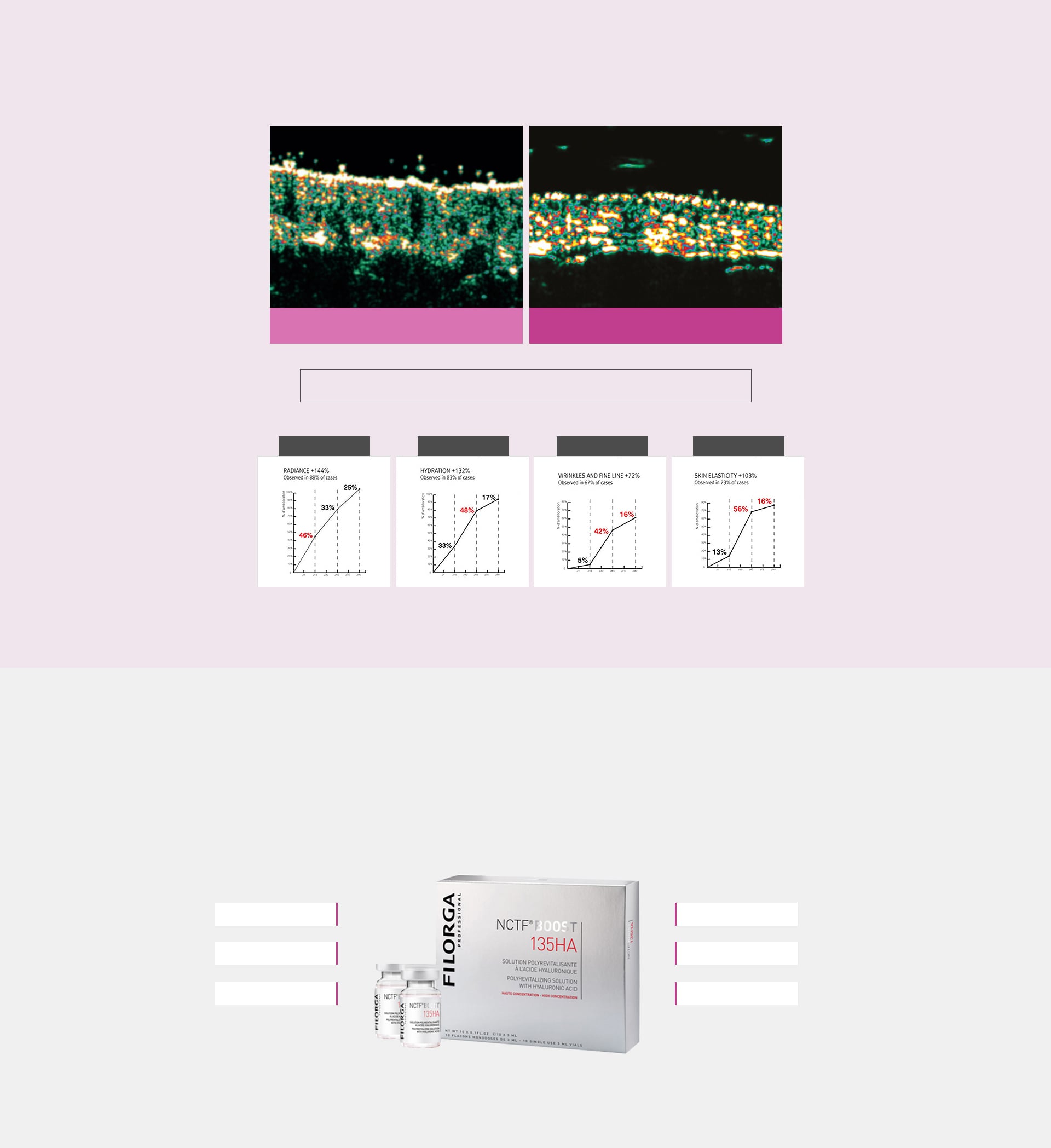 การเปลี่ยนแปลงของผิวและผลลัพธ์ก่อนหลังการทำหัตถการฟิลเมด