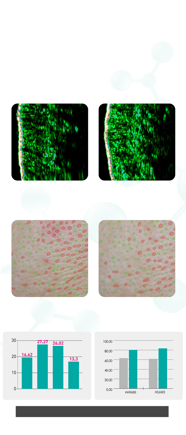 ประสิทธิภาพของรีจูรัน ฮีลเลอร์