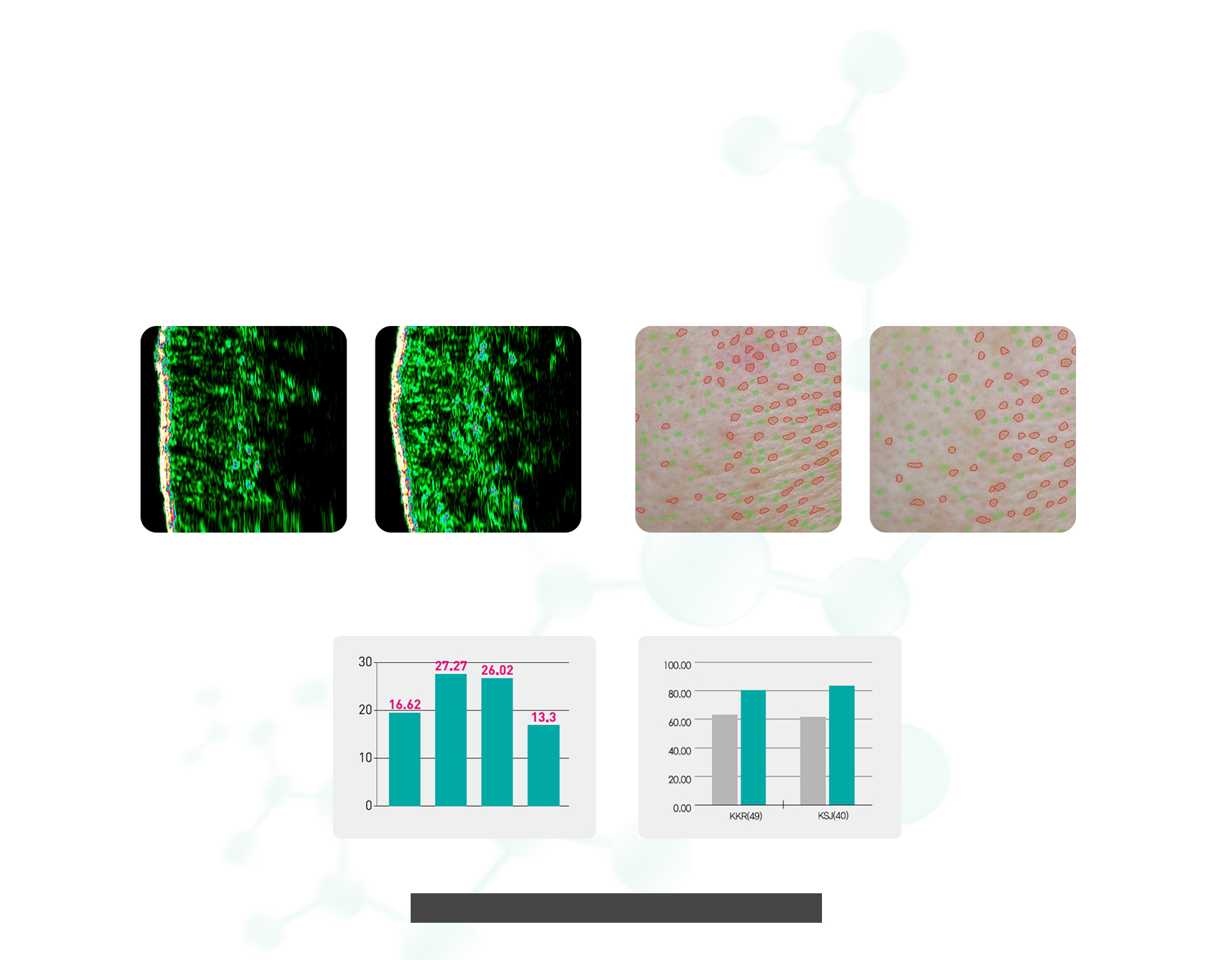 ประสิทธิภาพของรีจูรัน ฮีลเลอร์